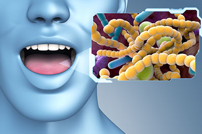 The image shows a 3D rendering of a human face with an open mouth, overlaid with a graphic representation of bacteria or microbes.