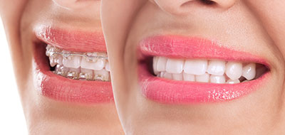 A close-up of a smiling woman s face, highlighting her teeth and lips.