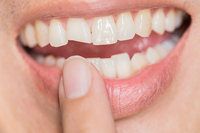 The image shows a person s hand holding a toothbrush with bristles, poised to brush teeth.