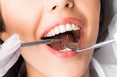 A woman undergoing a dental procedure, with a dentist using a drill on her tooth, surrounded by dental instruments and equipment.