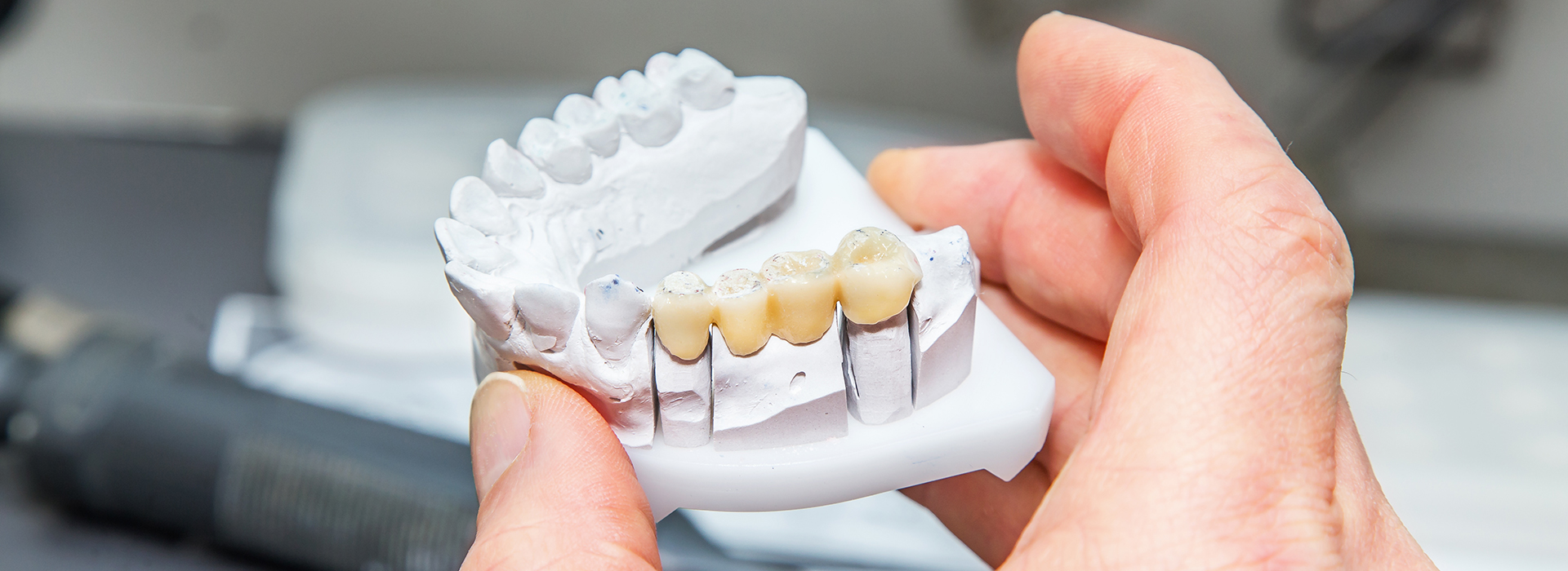 The image shows a person holding a 3D printed model of a human mouth with teeth, possibly for dental modeling or educational purposes.