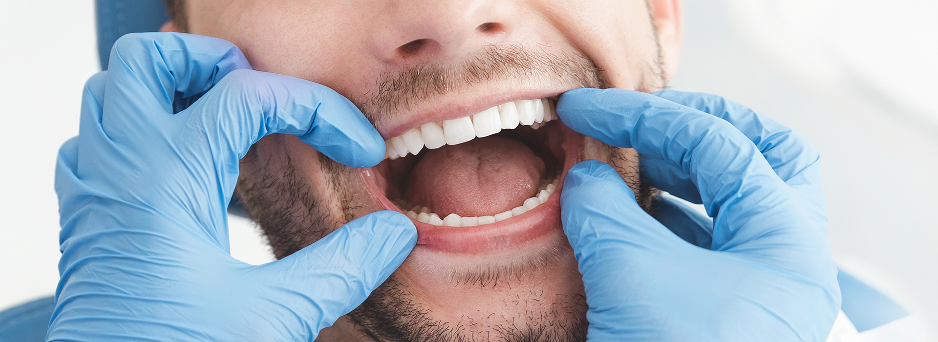 A man in a white coat with a stethoscope around his neck is holding open his mouth, revealing his teeth, while wearing blue surgical gloves.