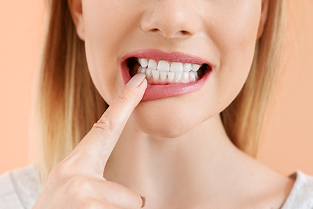 Serene Dental